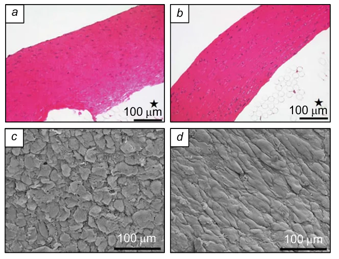 Morphology of pristine (a, c) and stimulated (b, d) scaffolds.316 Figs a, b are tissue sections (hematoxylin eosin staining), the asterisk marks the inner space of the channel; Figs c, d are SEM images of the surface. Published with permission from Springer Nature.
