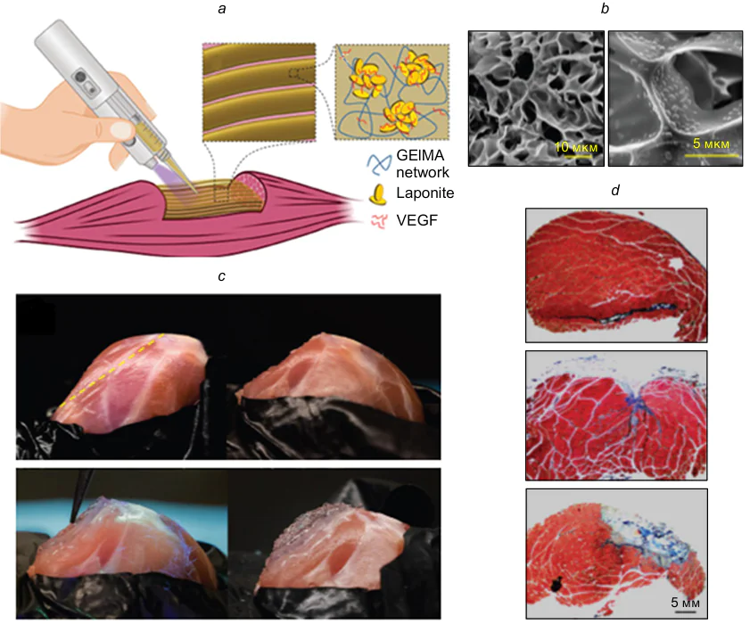 Scheme of obtaining a structurally organized scaffold directly in the wound using a handheld printer, insets – scheme of composite ink printed in the form of a scaffold from filaments (left) and its components, including VEGF bound to Laponite nanodisks and supported by GelMA hydrogel network (right) (a); SEM images of the scaffold structure at different magnifications (b); In situ 3D printing into an induced volumetric wound: intact quadriceps muscle with yellow dotted line indicating the location of muscle resection (top left), quadriceps after resection to simulate injury (top right), in situ ink printing process (bottom left) and reconstruction with a scaffold that replicates the geometry of the native muscle (bottom right) (c); image of muscle fibers stained with trichrome to show damage (fibrosis is in blue, muscles are in red) (d): intact tissue (top), damages tissue without scaffold (center), damaged tissue with scaffold (bottom). Adapted from paper210. SEM is scanning electron microscopy. The figure is reproduced with permission from Wiley under license No. 5394161333675.