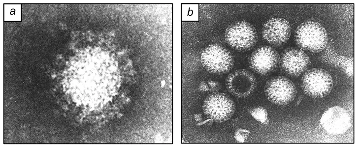 TEM images of the coronavirus (a) and rotavirus (b) virions (250000 magnification). The photographs from the personal archive of E.F.Panarin were presented at the symposium Improvement of the Preparedness for Influenza Pandemic based on the Civilian Military Cooperation (A.K.Sirotkin, I.S.Kochetkova, E.F.Panarin. Proceedings of the Symposium. St. Petersburg, 2003, p. 58).