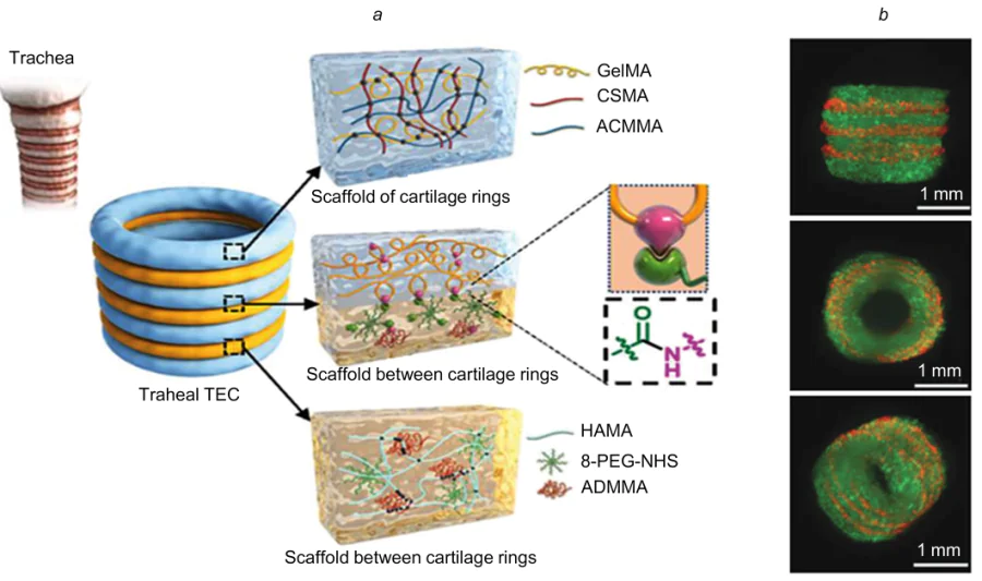 Schematic representation of tracheal TEC obtained by ink photopolymerization (to make scaffolds of cartilage rings and fibrous tissue) and amidation reaction (for interfacial binding) (a), and 3D images of cell distribution in tracheal TEC in three projections, made using fluorescence microscopy: chondrocytes labeled with green fluorescent protein (GFP) are stained green; fibroblasts labeled with red fluorescent protein (RFP) are stained red (b). GelMA is methacrylated gelatin, CSMA is methacrylated chondroitin sulfate, ACMMA is methacryloyl-modified cell-free cartilage matrix, HAMA is methacrylated hyaluronic acid, 8-PEG-NHS is polyethylene glycol succinic acid ester, ADMMA is methacryloyl-modified cell-free matrix of dermis. Adapted from paper.184 The figure is published under the Creative Commons Attribution 4.0 International license (CC BY 4.0).