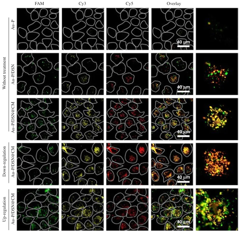 Fluorescence images of MCF-7 cells incubated with Au-P/DSN@CM and their precursors. Au-P/DSN@CM are gold nanoparticles functionalized with a vector (P) to definite mRNA and with double-specific nucleases and placed into a cell membrane (CM) vesicles. The signals of FAM (fluorescein), Cy3 (cyanine 3), and Cy5 (cyanine 5) fluorophores correspond to mRNA21 (green), mRNA155 (yellow), and mRNA205 (red). The signal appears when nanostructures bearing double-specific nucleases interact with mRNA and it is more intense for nanostructures occurring in CM vesicles, which provides higher cellular transfection efficiency. Down-regulation and up-regulation refer to decreasing or increasing mRNA expression attained by using small interfering RNA as regulators. The scale bar corresponds to 40 μm.110 Figure reproduced with permission from the American Chemical Society. 