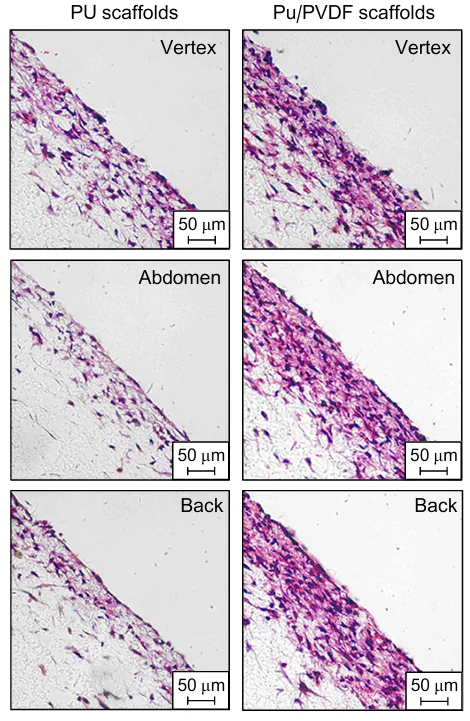 Cell in-growth depth of PVDF scaffolds (on the right) and conventional polyurethane scaffolds (on the left).360 Published with permission from Elsevier.