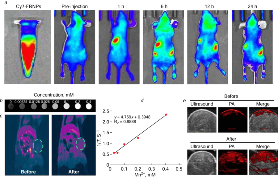 (a) In vivo fluorescence images of a mouse before and after injection of the agent based on gold nanocages, manganese dioxide, and cyanine 7 (Cy7-FRNPs); (b) T1-weighted phantom images with different FRNP concentrations; (c) in vivo MRI images of the tumour site before and after the injection of FRNPs; (d) spin – lattice relaxation rates for solutions of FRNPs at different Mn2+ concentrations; (e) in vivo photoacoustic image of the tumour site before and after injection of FRNPs.192 Figure reproduced with permission from the Dove Medical Press.