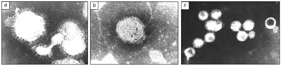TEM images of the interaction of Katapol nanoparticles with the virions of influenza virus (C=0.005%) (a), coronavirus (C=0.05%) (b), rotavirus (C=0.05%) (c). Figure a shows fusion of Katapol nanoparticles with the virion envelope (400000 magnification); Figureb depicts the destruction of surface receptors and disruption of the integrity of the virion envelope (250000 magnification). The photographs from the personal archive of E.F.Panarin were presented at the symposium Improvement of the Preparedness for Influenza Pandemic based on the Civilian Military Cooperation (A.K.Sirotkin, I.S.Kochetkova, E.F.Panarin. Proceedings of the Symposium. St. Petersburg, 2003, p. 59).