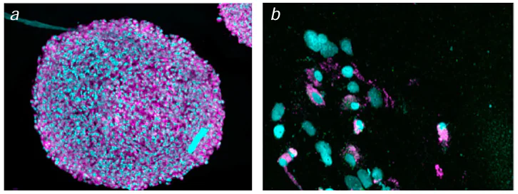 (a) Fluorescence image of the U87 MG cell spheroid after 24-hour incubation with gold nanoparticles modified with diethylenetriaminepentaacetic acid bearing conjugated cyanine 5. The pink colour is due to nanoparticles localized in cytosol and the blue colour is caused by hoechst 33342 nucleus stain. (b) Fluorescence image of single U87 MG cells after dissociation of the spheroid.178