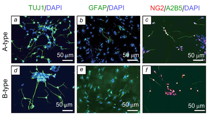 Immunofluorescence images of neurons (a, d), astrocytes (b, e) and oligodendrocyte precursors (c, f) differentiating on PVDF scaffolds of two types.290 A-type: PVDF membranes with fibre diameter of 200 nm, B-type: PVDF membranes with fibre diameter of 700 nm, DAPI (4',6-diamino-2-phenylindole dihydrochloride) is a blue fluorescence dye, TUJ1 is anti-beta III tubulin antibody (class III beta-tubulin is a neuron-specific protein of microtubules), GFAP is anti-glial fibrillary acid protein antibody (the main structural component of astrocytes), NG2 is antibody against the glycoprotein of the chondroitin sulfate proteoglycan family (neuroglia component), A2B5 is antibody against the ganglioside expressed by oligodendrocyte precursor cells.
