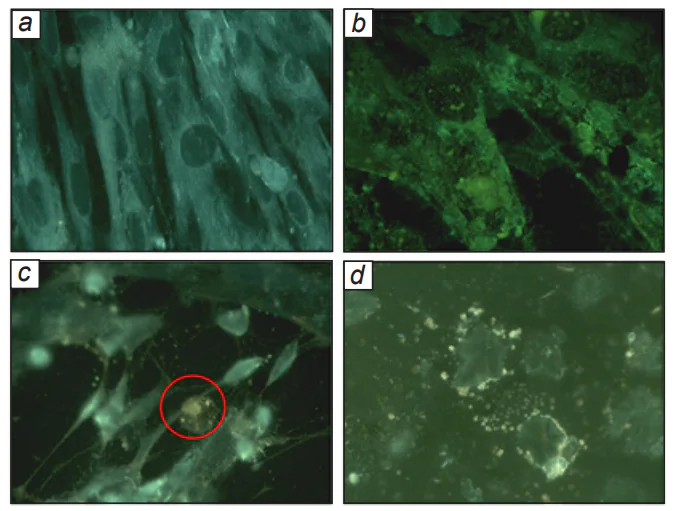 Micrographs (optical luminescence microscopy) of the changes in healthy cells after infection with CMV: (a) healthy cell monolayer; (b) 24 h after the infection: monolayer loosening, change of cell shape to more rounded, enlargement of nuclei, intense luminescence of nuclear cells; (c) 48 h after the infection: some of nuclear inclusions are surrounded by a light rim, which imparts the ‘owl’s eye’ look (marked in red); voids with remaining parts of cell matrix fibres are seen in place of destroyed cells; and cell orientation disorder. Simultaneously, cells without visible changes can also be seen; (d) 72 h after the infection: complete destruction of the monolayer, remainder of the cell matrix.